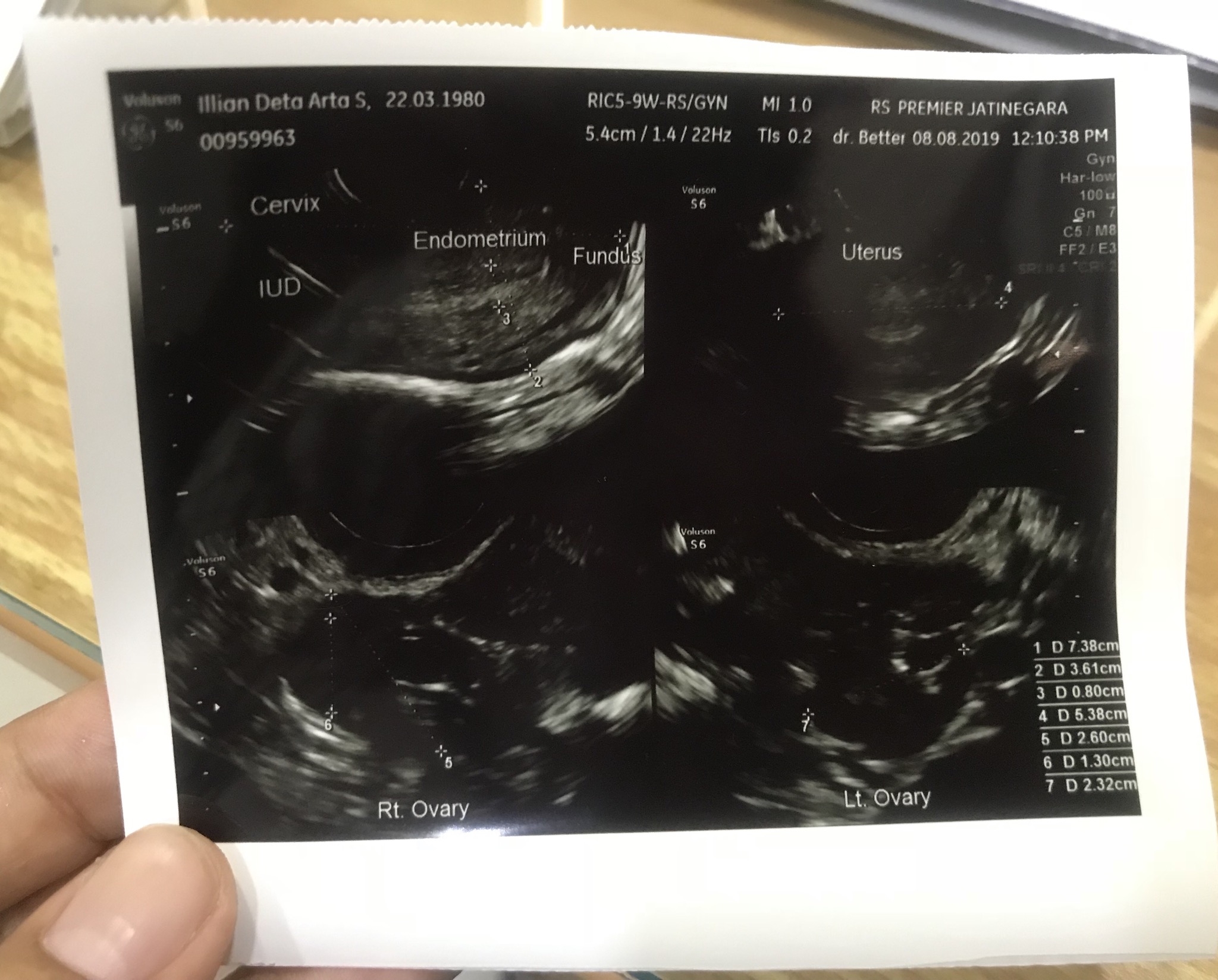 CEA86998-F113-45ED-B621-6FE8C357F568